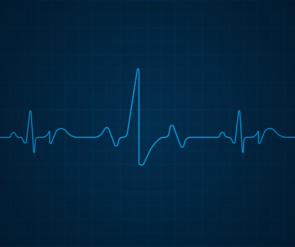 heart rate monitor